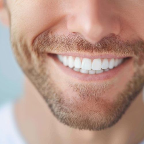 sorriso-uomo